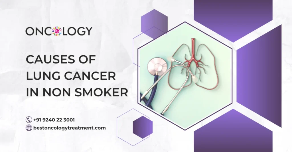Causes Of Lung Cancer In Non Smoker